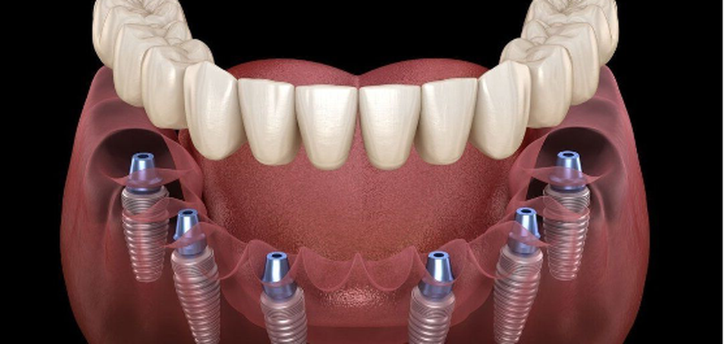 Implantologia, Parodontologia e Chirurgia